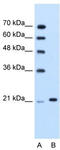Tripartite Motif Containing 26 antibody, TA335778, Origene, Western Blot image 