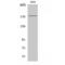 Insulin Receptor Substrate 1 antibody, LS-C384194, Lifespan Biosciences, Western Blot image 