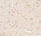 Late Endosomal/Lysosomal Adaptor, MAPK And MTOR Activator 3 antibody, A08040, Boster Biological Technology, Immunohistochemistry frozen image 