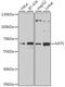 Lysine Acetyltransferase 5 antibody, A1678, ABclonal Technology, Western Blot image 