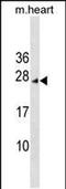 Inhibitor Of CDK, Cyclin A1 Interacting Protein 1 antibody, PA5-48921, Invitrogen Antibodies, Western Blot image 