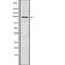 PNN Interacting Serine And Arginine Rich Protein antibody, abx148759, Abbexa, Western Blot image 