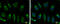 Heat Shock Protein Family A (Hsp70) Member 5 antibody, GTX127934, GeneTex, Immunofluorescence image 