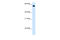 Aldehyde Dehydrogenase 4 Family Member A1 antibody, 30-100, ProSci, Immunohistochemistry paraffin image 