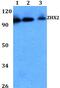 Zinc Fingers And Homeoboxes 2 antibody, PA5-75790, Invitrogen Antibodies, Western Blot image 