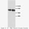 Transient Receptor Potential Cation Channel Subfamily V Member 1 antibody, LS-C172124, Lifespan Biosciences, Western Blot image 