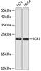 Insulin Like Growth Factor 1 antibody, 14-216, ProSci, Western Blot image 