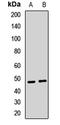 Cytochrome P450 Family 2 Subfamily C Member 18 antibody, orb412604, Biorbyt, Western Blot image 