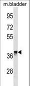 Crystallin Mu antibody, LS-C157663, Lifespan Biosciences, Western Blot image 