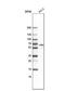 Actin Binding LIM Protein Family Member 3 antibody, NBP1-81471, Novus Biologicals, Western Blot image 