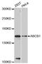ATP Binding Cassette Subfamily B Member 1 antibody, abx125475, Abbexa, Western Blot image 
