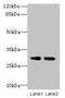 Axonemal dynein light intermediate polypeptide 1 antibody, CSB-PA007047LA01HU, Cusabio, Western Blot image 