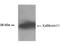 Kallikrein Related Peptidase 11 antibody, NB100-429, Novus Biologicals, Western Blot image 