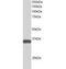 STE20 Related Adaptor Beta antibody, GTX24122, GeneTex, Western Blot image 