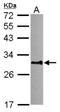 Dynein Axonemal Light Intermediate Chain 1 antibody, NBP2-16197, Novus Biologicals, Western Blot image 