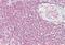Mitogen-Activated Protein Kinase Kinase 3 antibody, MBS244696, MyBioSource, Immunohistochemistry paraffin image 