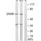 Protein Phosphatase 2 Scaffold Subunit Abeta antibody, A05756, Boster Biological Technology, Western Blot image 