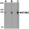 Stromal Interaction Molecule 2 antibody, TA306423, Origene, Western Blot image 