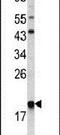 Actin Related Protein 2/3 Complex Subunit 3 antibody, PA5-13549, Invitrogen Antibodies, Western Blot image 