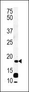 2'-Deoxynucleoside 5'-Phosphate N-Hydrolase 1 antibody, 62-108, ProSci, Western Blot image 