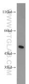 Interferon Regulatory Factor 5 antibody, 10547-1-AP, Proteintech Group, Western Blot image 