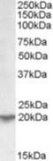 Ubiquitously Expressed Prefoldin Like Chaperone antibody, NBP1-00129, Novus Biologicals, Western Blot image 