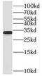 TIR domain-containing adapter molecule 2 antibody, FNab08687, FineTest, Western Blot image 