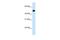 3-Hydroxy-3-Methylglutaryl-CoA Synthase 2 antibody, GTX47145, GeneTex, Western Blot image 