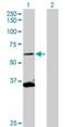 Scm Polycomb Group Protein Homolog 1 antibody, H00022955-D01P, Novus Biologicals, Western Blot image 