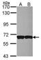 CD97 antigen antibody, PA5-28760, Invitrogen Antibodies, Western Blot image 