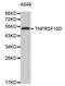 TNF Receptor Superfamily Member 10d antibody, STJ25887, St John