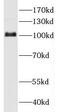 Hexokinase 1 antibody, FNab03893, FineTest, Western Blot image 