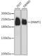 DNA Methyltransferase 1 antibody, A15050, ABclonal Technology, Western Blot image 