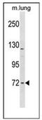 Formin Binding Protein 1 Like antibody, AP51691PU-N, Origene, Western Blot image 