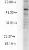 Gamma-Aminobutyric Acid Type A Receptor Delta Subunit antibody, LS-C229902, Lifespan Biosciences, Western Blot image 