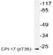 Protein Phosphatase 1 Regulatory Inhibitor Subunit 14A antibody, AP20858PU-N, Origene, Western Blot image 