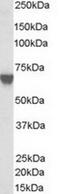 Target Of Myb1 Like 2 Membrane Trafficking Protein antibody, TA302974, Origene, Western Blot image 