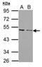 Atypical Chemokine Receptor 3 antibody, PA5-27077, Invitrogen Antibodies, Western Blot image 