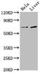 Afadin- and alpha-actinin-binding protein antibody, LS-C672231, Lifespan Biosciences, Western Blot image 