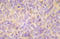 Mitogen-Activated Protein Kinase Kinase Kinase 5 antibody, AP21015PU-N, Origene, Immunohistochemistry frozen image 