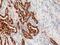 Surfactant Protein B antibody, M03441, Boster Biological Technology, Immunohistochemistry frozen image 