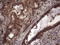 Ubiquitin Recognition Factor In ER Associated Degradation 1 antibody, LS-C790233, Lifespan Biosciences, Immunohistochemistry paraffin image 