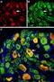 Acid Sensing Ion Channel Subunit 3 antibody, PA5-77734, Invitrogen Antibodies, Immunohistochemistry frozen image 