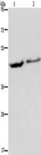 Eukaryotic Translation Initiation Factor 3 Subunit H antibody, TA349924, Origene, Western Blot image 