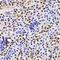 GA Binding Protein Transcription Factor Subunit Beta 1 antibody, GTX33210, GeneTex, Immunohistochemistry paraffin image 