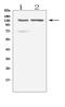 Regulator of telomere elongation helicase 1 antibody, A01544-1, Boster Biological Technology, Western Blot image 