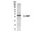 Interleukin 18 Binding Protein antibody, TA336593, Origene, Western Blot image 