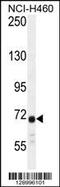 Ataxin 7 Like 2 antibody, 55-765, ProSci, Western Blot image 