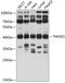 Tropomodulin 3 antibody, 19-441, ProSci, Western Blot image 