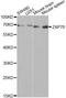 Zeta Chain Of T Cell Receptor Associated Protein Kinase 70 antibody, A2195, ABclonal Technology, Western Blot image 